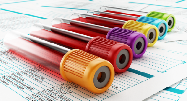 vial of blood for testing