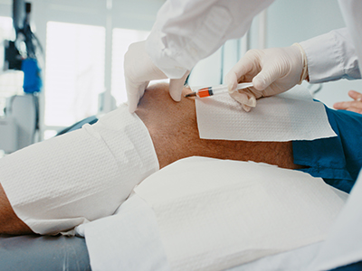 Joint Fluid and Tissue Tests for Arthritis