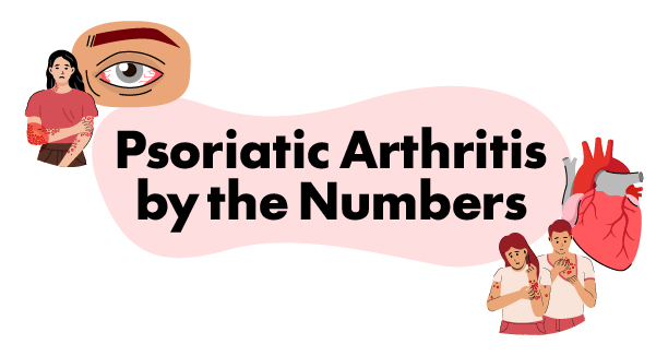 Psoriatic Arthritis by the Numbers 