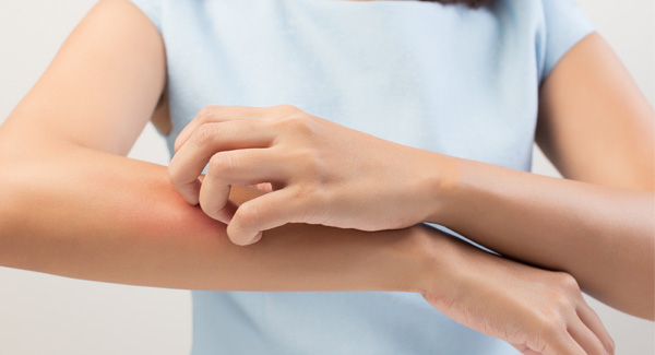 Managing Skin and Nail Problems With Psoriatic Arthritis 