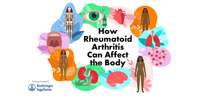 How RA Can Affect the Body