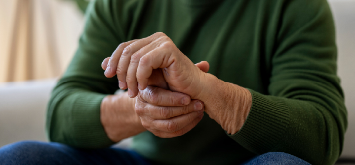Rheumatoid Arthritis Explained 