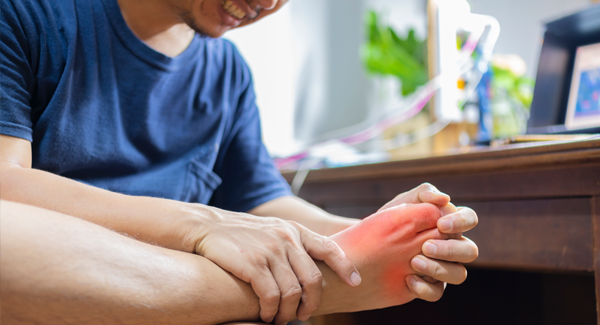 Managing a Gout Flare