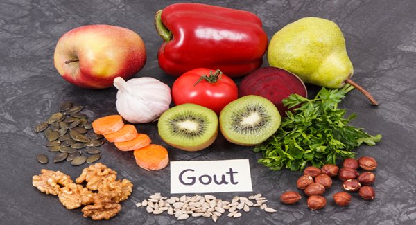 Webinar: The Role of Diet in Gout Management
