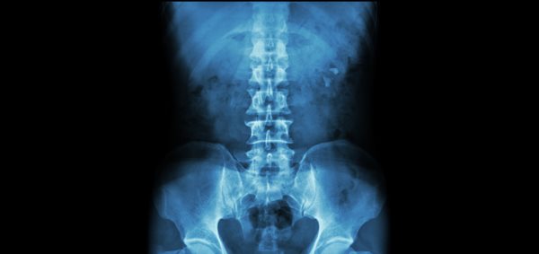 Anatomy of the Spine Upper Back, Lower Back and Neck