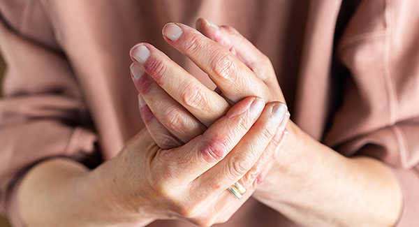 Psoriasis May Lead to Psoriatic Arthritis