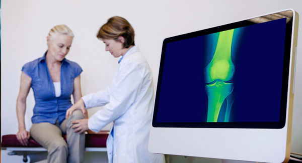 Guidelines for Osteoarthritis Treatments 