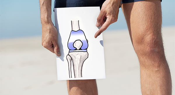 Knee Replacement Aftercare: Tips for Patients and Caregivers