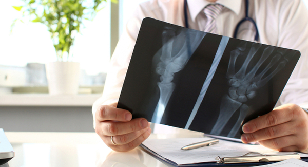 Pruebas de diagnóstico por imágenes y de los nervios para controlar la artritis