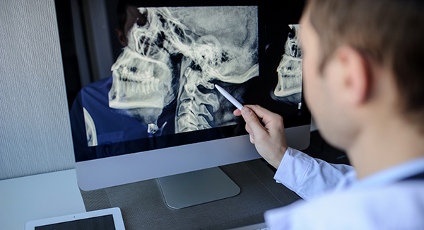 Vagus Nerve Therapy for Rheumatoid Arthritis 